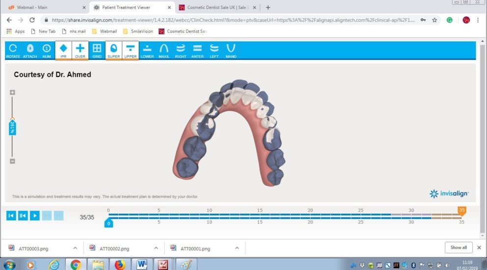 Blog - Sale Dental Spa