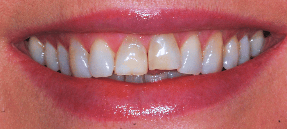 Before - Sale Dental Spa