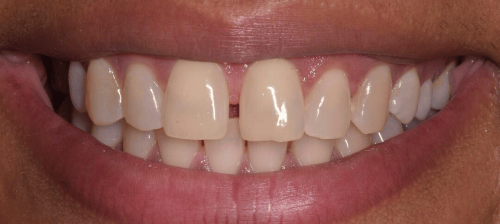 Before - Sale Dental Spa