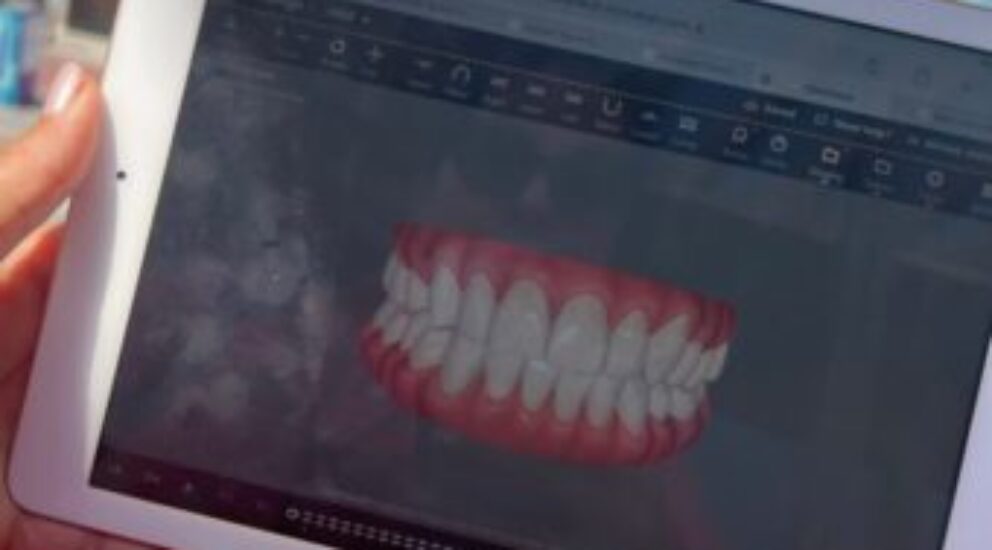 Blog - Sale Dental Spa