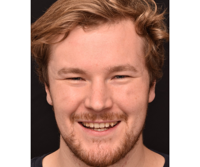 Dr Mark Williams, cosmetic dentist and Invisalign provider at Sale Dental Spa