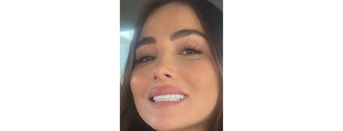 Woman covering mouth looking worried about dental problems after cosmetic dentistry abroad, illustrating risks of dental tourism